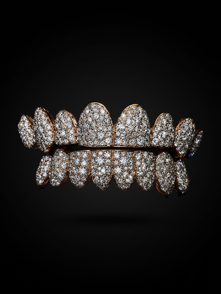 Custom diamond pavé grillz in rose gold by ETR Jewellers